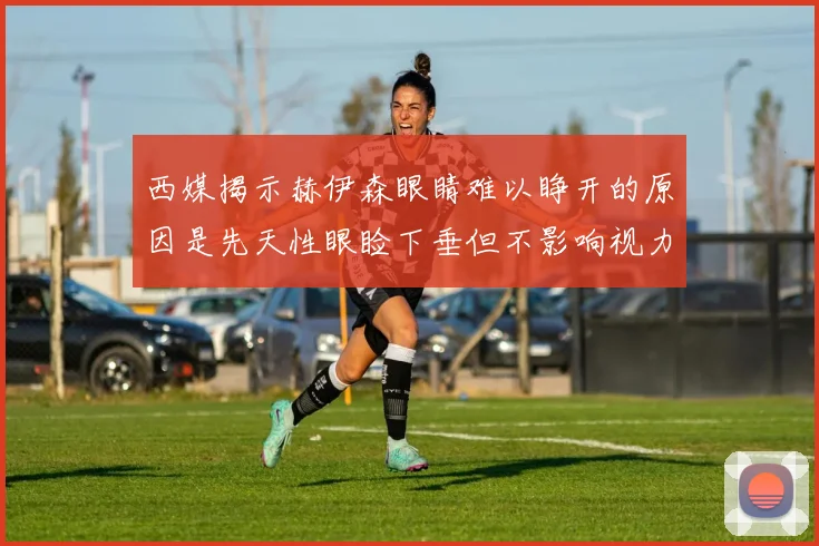 西媒揭示赫伊森眼睛难以睁开的原因是先天性眼睑下垂但不影响视力